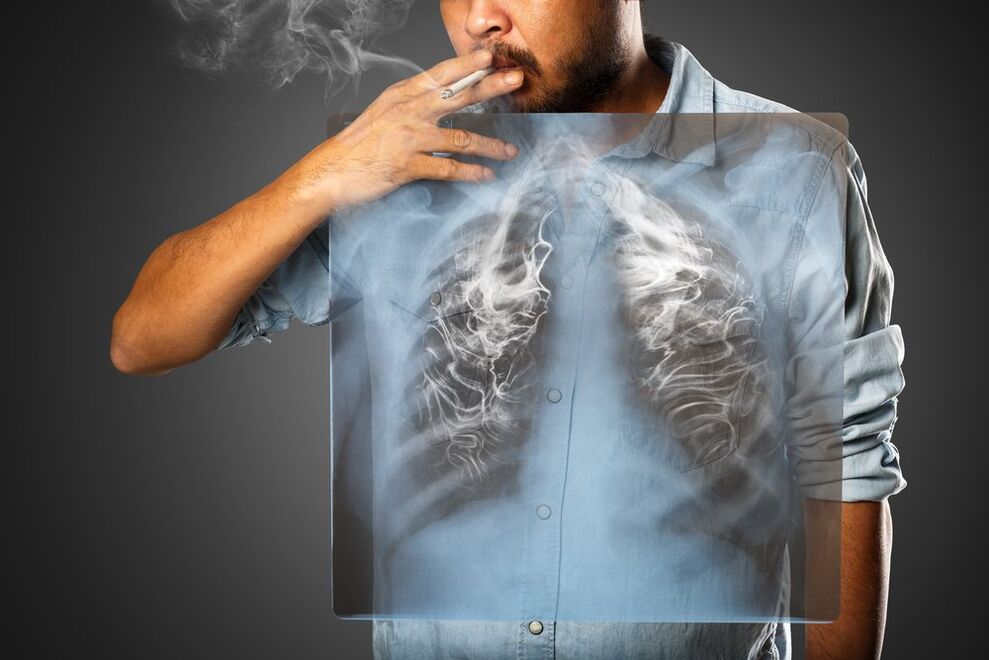 sigara içmek insan vücudu üzerinde zararlı bir etkiye sahiptir